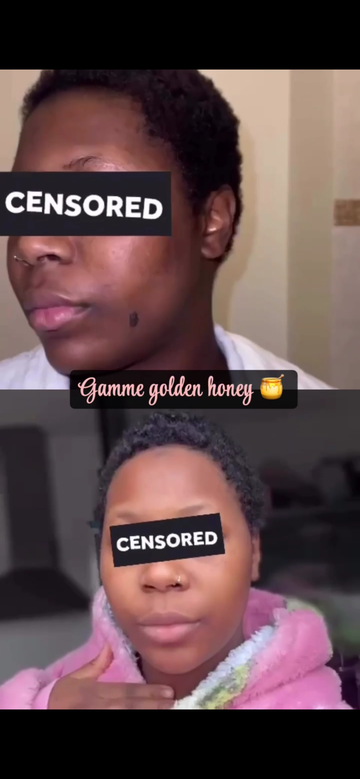Kit Visage Golden Honey