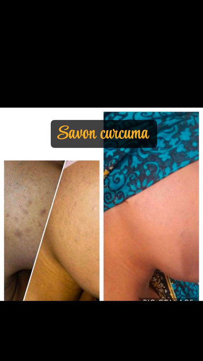 Savon Magic Curcuma