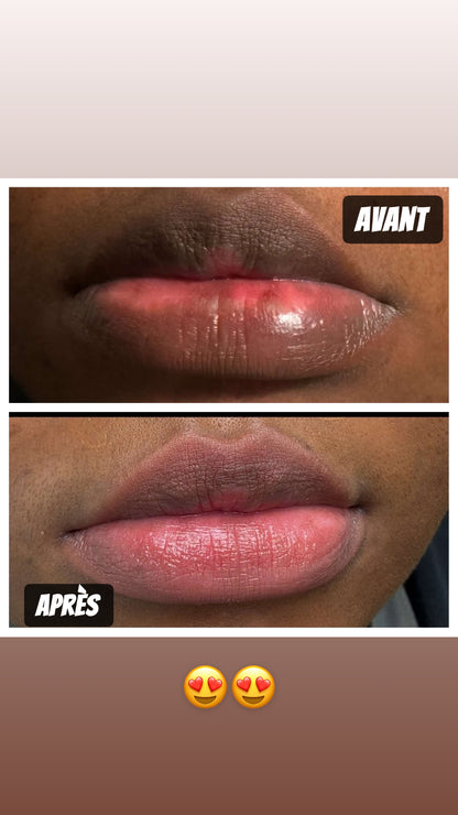 Kit Lèvre Rose 🫦